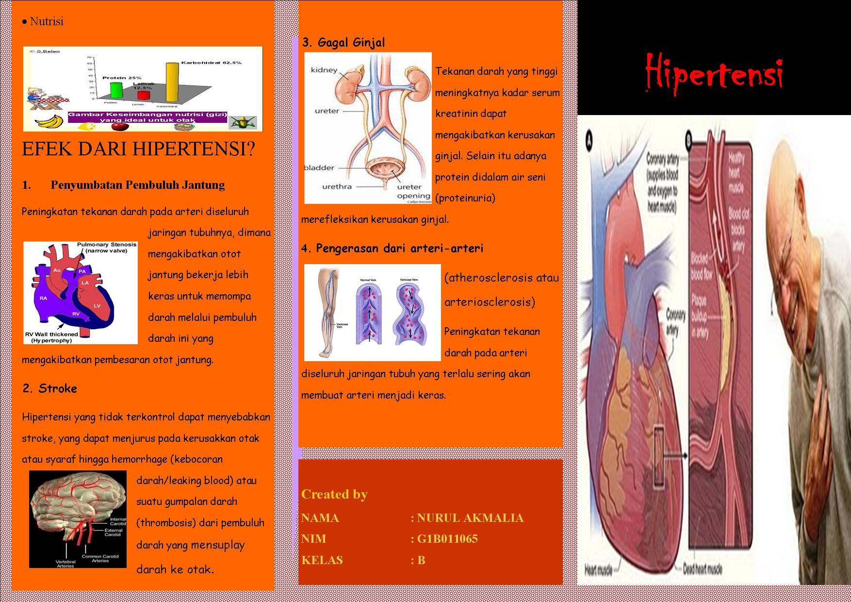 Leaflet kesehatan  PUBLIC HEALTH